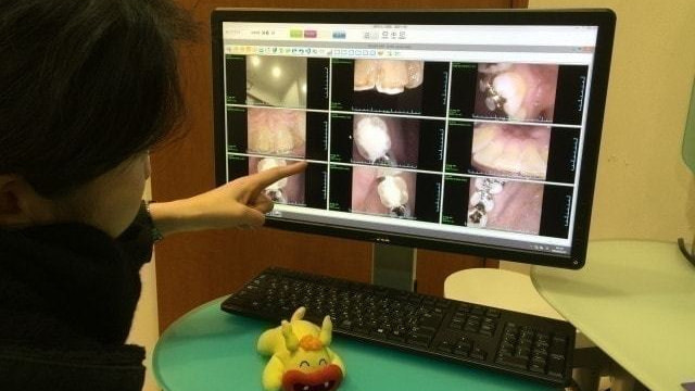口腔内写真